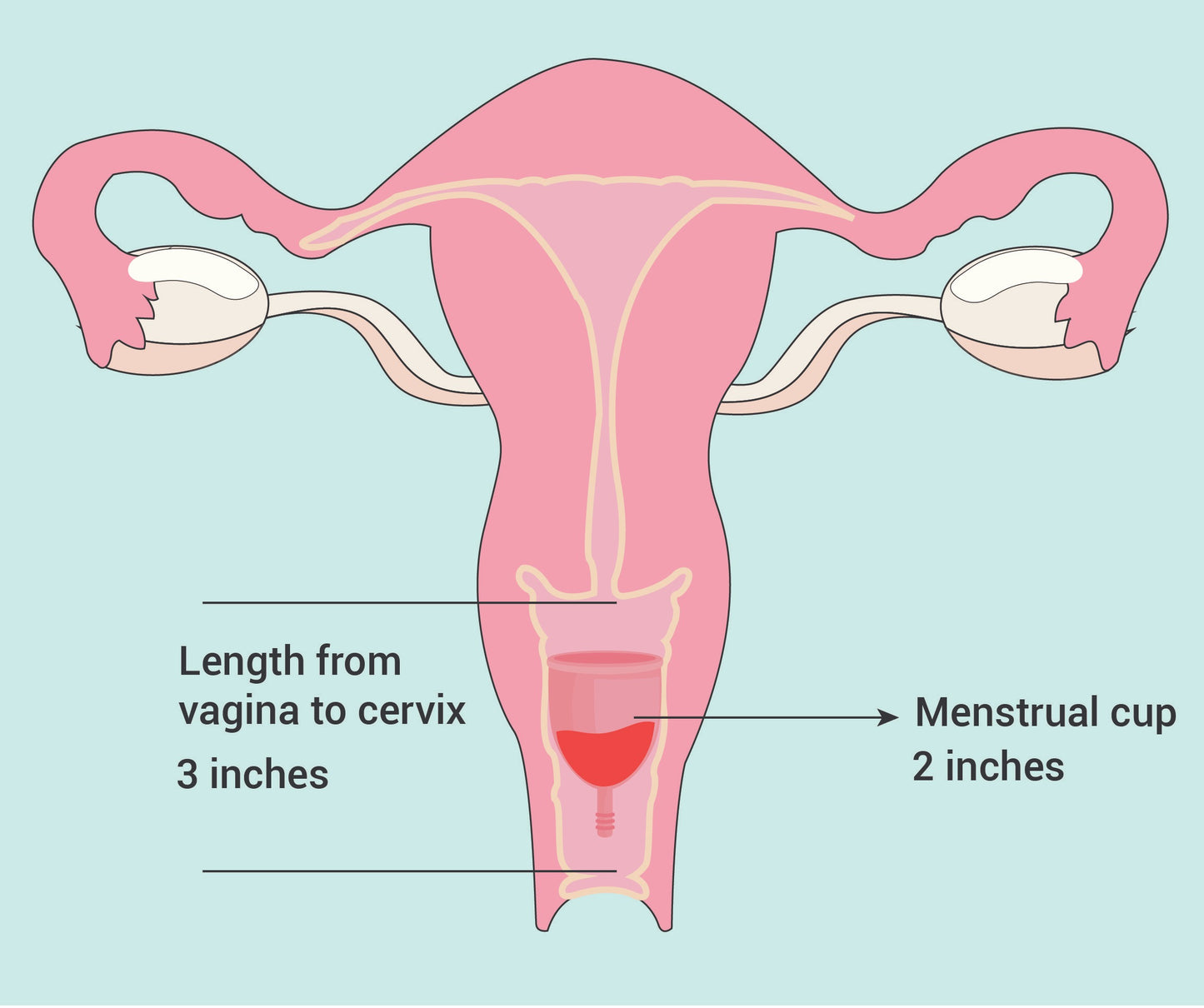 Menstrual Cup